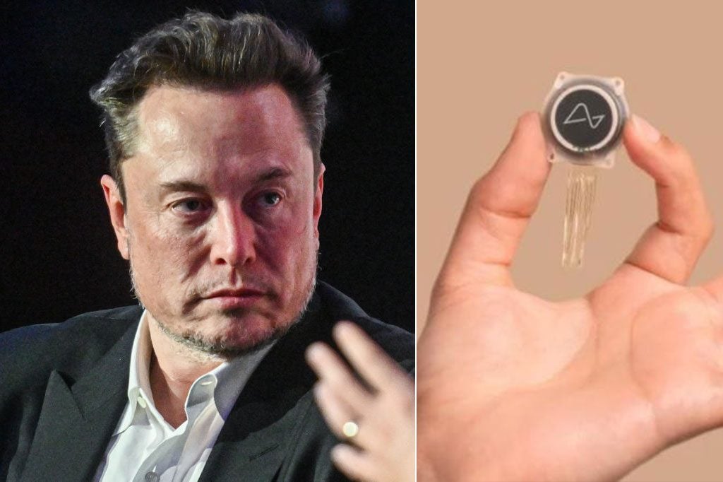 Neuralink's new test for a brain implant connected to a robotic arm: “It will be revolutionary”