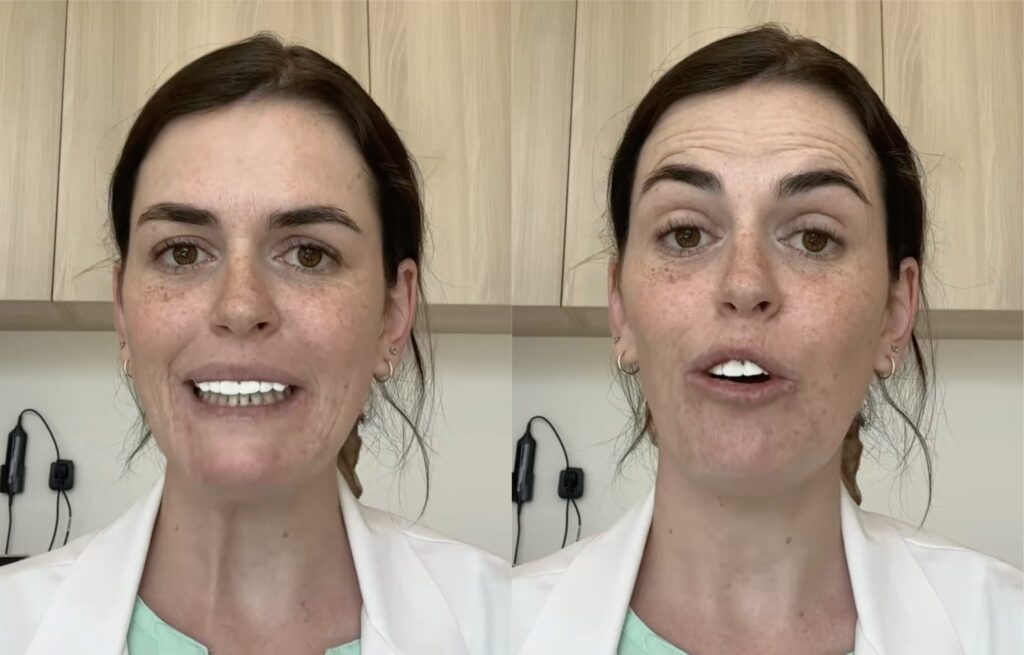 The case of the dentist Valentina, she becomes famous on social media with a trick: just look at the smile